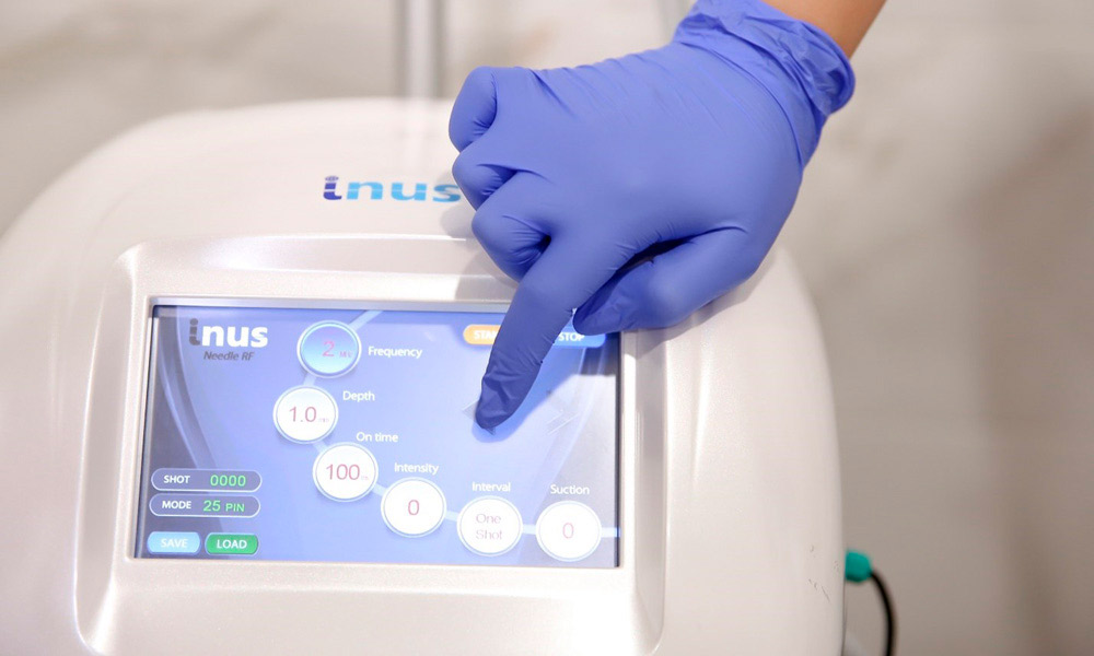 Новая RF-технология Inus - это быстрый и долгосрочный результат с доказанной клинической эффективностью
